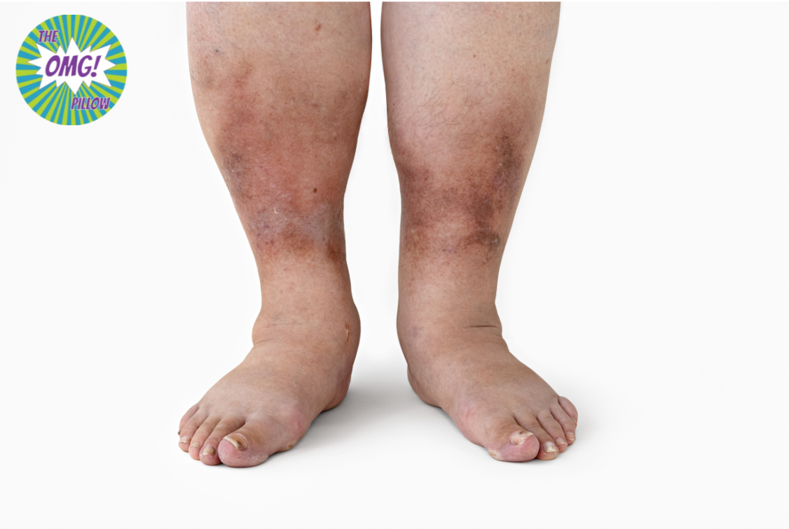 O.M.G Pillow: A Vibrating Massage Pillow for Improved Circulation and Diabetic Leg Comfort