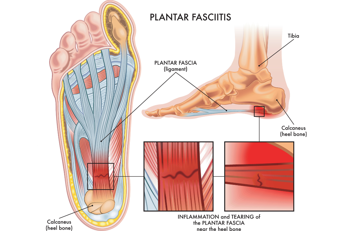 Foot Pillow